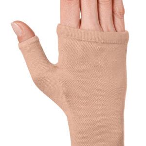 Компрессионная перчатка с открытыми пальцами круговой вязки для эффективной профилактики развития лимфатического отека тыла кисти после перенесенной мастэктомии. Компрессионная перчатка закрывает запястье и кисть.